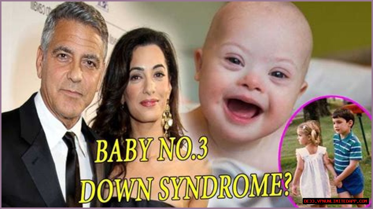 George Clooney's Son: Navigating Life With Down Syndrome