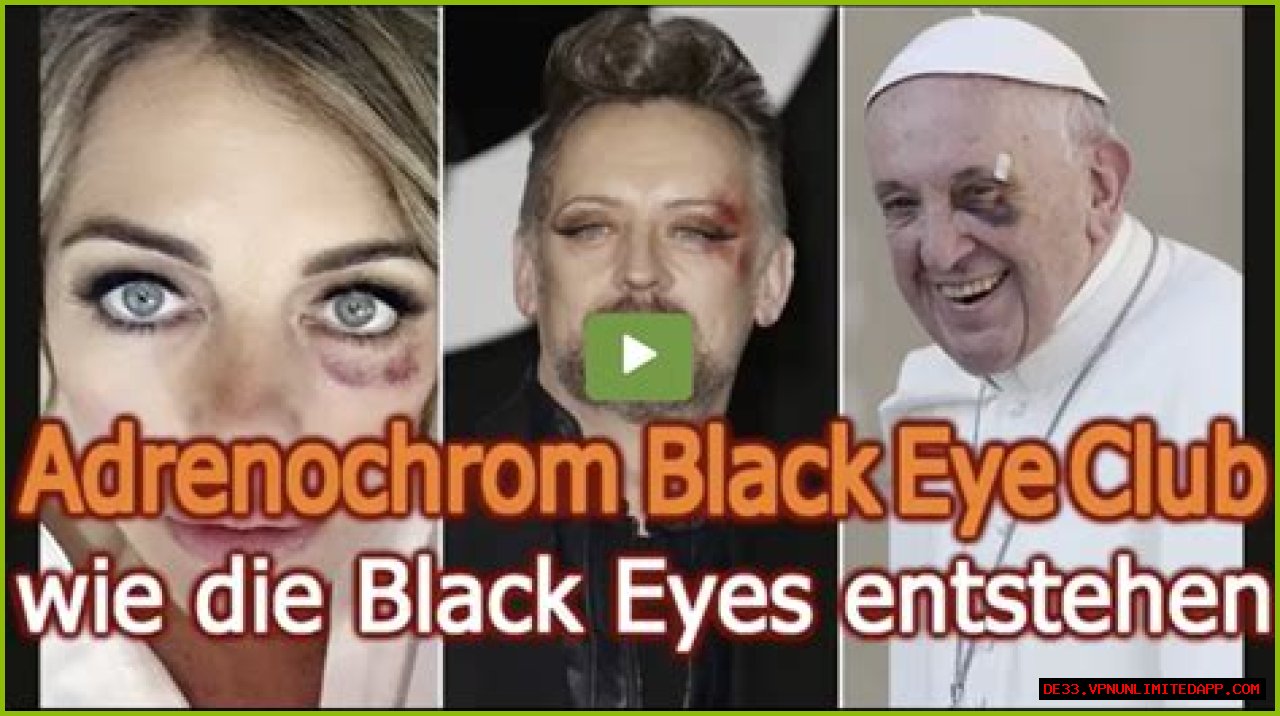 Unveiling The Mystique Of The Black Eye Club