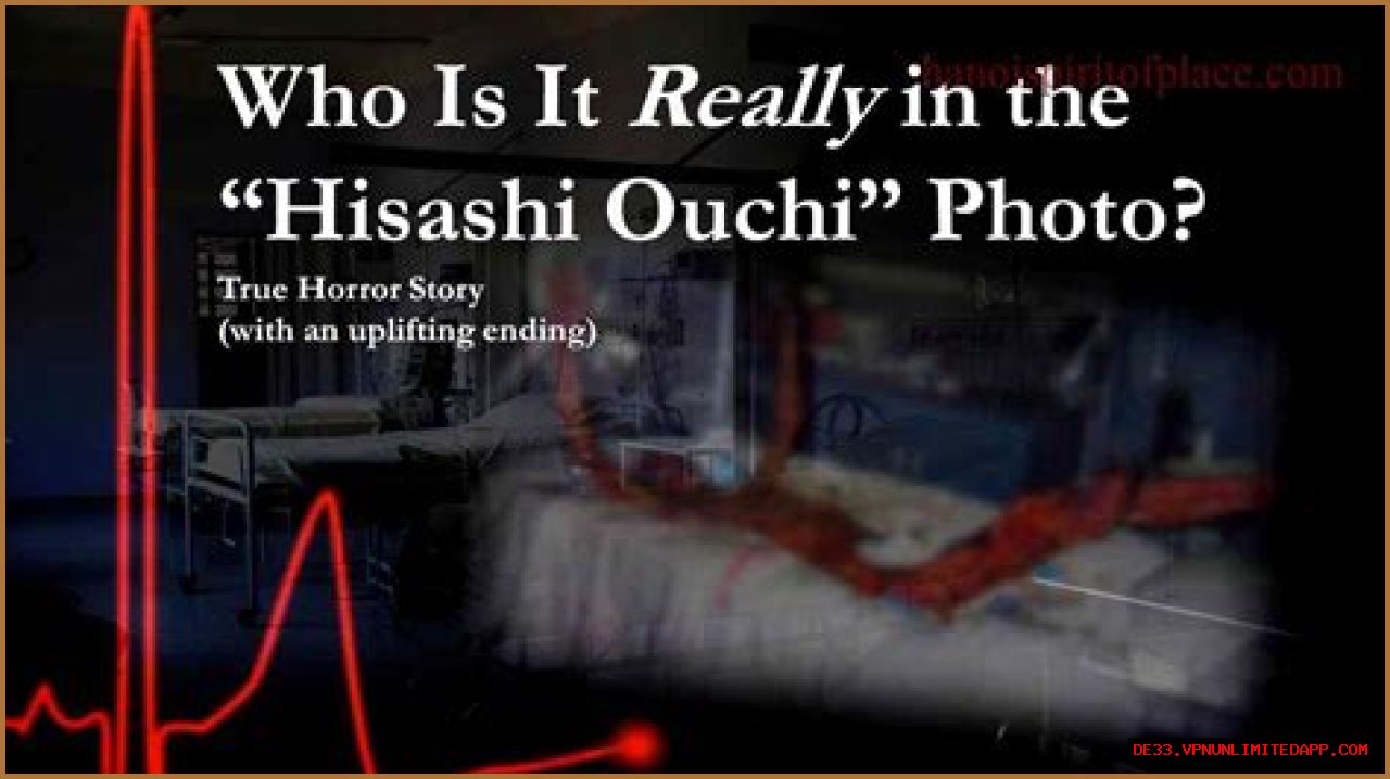 Unveiling The Tragic Story Behind Hisashi Ouchi Hospital Photos